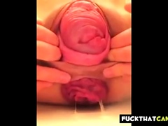 Pussy Prolapse